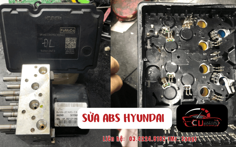 SỬA ABS HYUDAI HCM - SỬA BƠM ABS CHUYÊN NGHIỆP 1 Tìm hiểu sơ lược về hệ thống ABS trên xe Hyundai