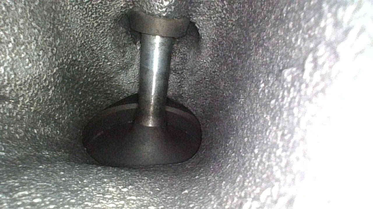 Vệ sinh họng nạp chuyên sâu Vệ sinh họng nạp chuyên sâu